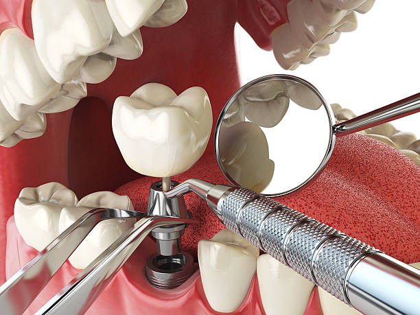 Best Emergency Dental Surgery in North Hartsville, SC